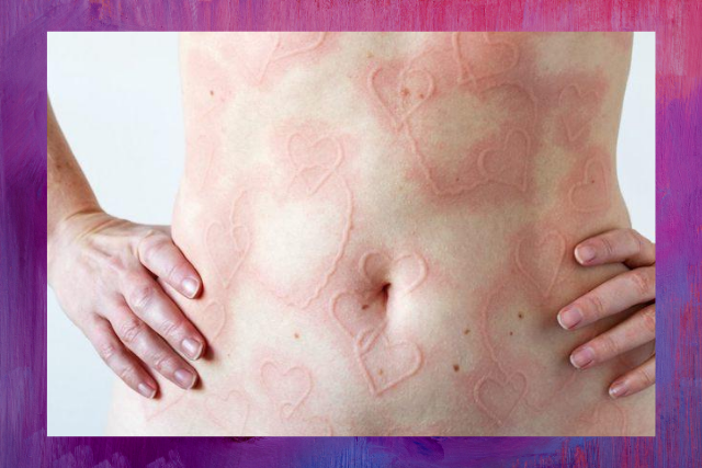 How to Use Your Flaws as Creative Inspiration